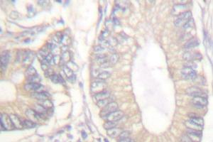 Image no. 1 for anti-Gastrin (GAST) antibody (ABIN265432) (Gastrin antibody)