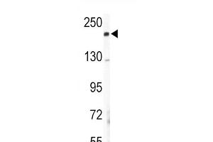 Western blot analysis of COL5A2 Antibody (N-term) (ABIN391537 and ABIN2841488) in mouse lung tissue lysates (35 μg/lane). (COL5A2 antibody  (N-Term))