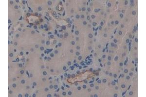 Immunohistochemistry (IHC) image for anti-Mucin 1 (MUC1) (AA 474-630) antibody (ABIN7442027)