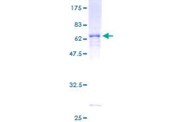 AASDHPPT Protein (AA 1-309) (GST tag)