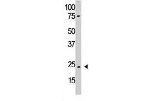 The PDGFA polyclonal antibody  is used in Western blot to detect PDGFA in HL-60 cell lysate.