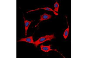 Immunofluorescent analysis of HER4 (pY1284) staining in MCF7 cells. (ERBB4 antibody  (C-Term, pTyr1284))