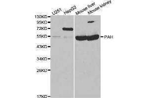 Western blot analysis of extracts of various cell lines, using PAH antibody. (Phenylalanine Hydroxylase antibody  (AA 1-290))
