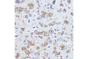 Immunohistochemistry of paraffin-embedded mouse brain using EL Rabbit pAb (ABIN7266914) at dilution of 100 (40x lens). (ELAVL4 antibody  (AA 1-366))