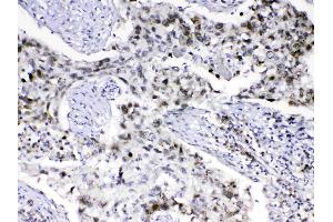 Immunohistochemistry (IHC) image for anti-Mediator Complex Subunit 18 (MED18) (AA 1-208) antibody (ABIN5519036)