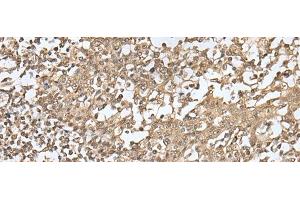Immunohistochemistry of paraffin-embedded Human tonsil tissue using ZKSCAN1 Polyclonal Antibody at dilution of 1:30(x200) (ZKSCAN1 antibody)