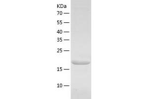 Western Blotting (WB) image for Lymphotoxin-alpha (LTA) (AA 34-202) protein (His tag) (ABIN7285183) (LTA Protein (AA 34-202) (His tag))