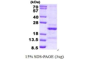 Steroid Receptor RNA Activator 1 (SRA1) (AA 90-236) protein (His tag)