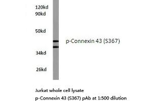 Western blot (WB) analyzes of p-Connexin 43 antibody in extracts from Jurkat cells. (Connexin 43/GJA1 antibody  (pSer367))