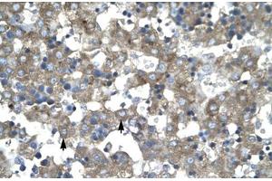 Immunohistochemical staining (Formalin-fixed paraffin-embedded sections) of human liver with KLF15 polyclonal antibody . (KLF15 antibody  (AA 45-94))