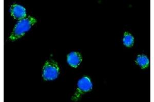 IF analysis of DLAT using anti-DLAT antibody .