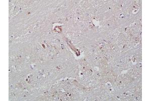 Formalin-fixed and paraffin embedded rat brain labeled with Rabbit Anti-ICAM-2/CD102 Polyclonal Antibody, Unconjugated  at 1:200 followed by conjugation to the secondary antibody and DAB staining (ICAM2 antibody  (AA 175-277))