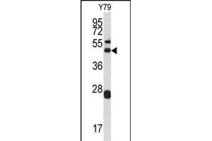Western blot analysis of ARPC1A antibody (Center) (ABIN390418 and ABIN2840806) in Y79 cell line lysates (35 μg/lane). (ARPC1A antibody  (AA 157-184))