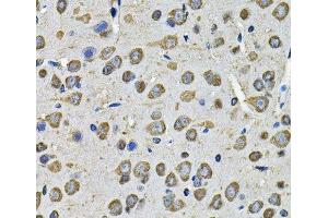 Immunohistochemistry of paraffin-embedded Rat brain using PDIA6 Polyclonal Antibody at dilution of 1:100 (40x lens). (PDIA6 antibody)