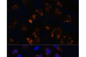Immunofluorescence analysis of U2OS cells using TGFB1 Polyclonal Antibody at dilution of 1:100. (TGFB1 antibody)