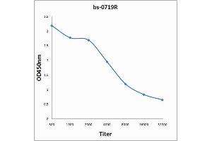 Antigen: 0. (CEA antibody  (AA 315-365))