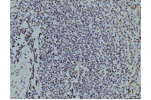 IHC analysis of LSM8 using anti-LSM8 antibody (ABIN7599578).