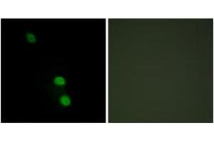 Immunofluorescence analysis of HepG2 cells, using TEAD2 Antibody.