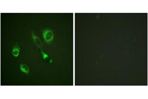 Immunofluorescence analysis of HeLa cells, using EPHA2/3 (Phospho-Tyr588/596) Antibody. (EPHA2/3 antibody  (pTyr588))