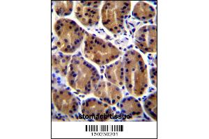 PKP2 Antibody immunohistochemistry analysis in formalin fixed and paraffin embedded human stomach tissue followed by peroxidase conjugation of the secondary antibody and DAB staining.