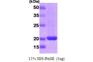 SDS-PAGE (SDS) image for Ras Homolog Enriched in Brain (RHEB) (AA 1-181) protein (T7 tag) (ABIN666866)