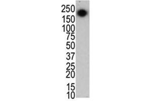 The LRRK2 antibody used in western blot to detect LRRK2/PARK8 in mouse brain cell lysate (LRRK2 antibody  (C-Term))