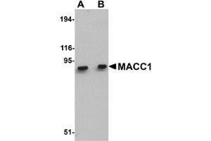 Western Blotting (WB) image for anti-Metastasis Associated in Colon Cancer 1 (MACC1) (Middle Region) antibody (ABIN1030992) (MACC1 antibody  (Middle Region))