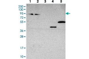 Western blot analysis of Lane 1: RT-4, Lane 2: U-251 MG, Lane 3: Human Plasma, Lane 4: Liver, Lane 5: Tonsil with ZNF235 polyclonal antibody  at 1:250-1:500 dilution. (ZNF235 antibody)