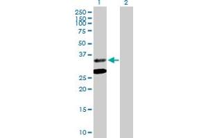 Western Blot analysis of ASPA expression in transfected 293T cell line by ASPA MaxPab polyclonal antibody.