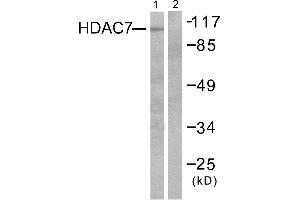 Western blot analysis of extracts from HuvEc cells, using HDAC7 antibody (#C0227).