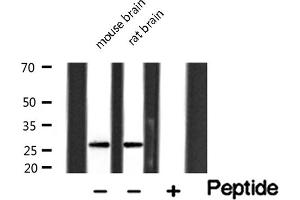 Western Blotting (WB) image for anti-Granzyme B (GZMB) antibody (ABIN6262072)
