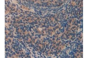 Detection of OLFM4 in Mouse Ovary Tissue using Polyclonal Antibody to Olfactomedin 4 (OLFM4)