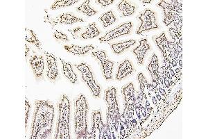 IHC analysis of H1F0 using anti-H1F0 antibody (ABIN7600521). (Histone H1 antibody  (AA 20-159))