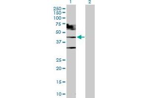 Western Blot analysis of TARDBP expression in transfected 293T cell line by TARDBP MaxPab polyclonal antibody. (TARDBP antibody  (AA 1-414))