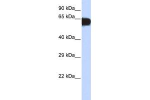 WB Suggested Anti-TBX18 Antibody Titration: 0. (T-Box 18 antibody  (Middle Region))