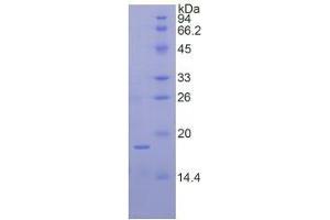 SDS-PAGE analysis of Human Ribonuclease A7 Protein. (RNASE7 Protein)