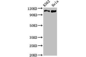 Western Blot Positive WB detected in: K562 whole cell lysate, Hela whole cell lysate All lanes: C16orf62 antibody at 3 μg/mL Secondary Goat polyclonal to rabbit IgG at 1/50000 dilution Predicted band size: 110, 94 kDa Observed band size: 110 kDa