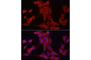 Immunofluorescence (IF) image for anti-Inositol Polyphosphate-5-Phosphatase K (INPP5K) (AA 149-448) antibody (ABIN6142473)