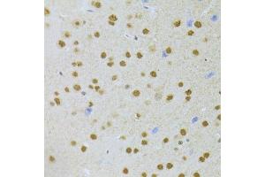 Immunohistochemistry (Paraffin-embedded Sections) (IHC (p)) image for anti-Acidic (Leucine-Rich) Nuclear phosphoprotein 32 Family, Member A (ANP32A) (AA 1-170) antibody (ABIN6136909)