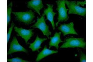 ICC/IF analysis of OTUB1 in HeLa cells line, stained with DAPI (Blue) for nucleus staining and monoclonal anti-human OTUB1 antibody (1:100) with goat anti-mouse IgG-Alexa fluor 488 conjugate (Green). (OTUB1 antibody  (AA 1-271))
