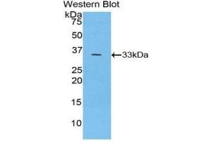 Detection of Recombinant PYGB, Human using Polyclonal Antibody to Glycogen Phosphorylase, Brain (PYGB) (PYGB antibody  (AA 477-731))