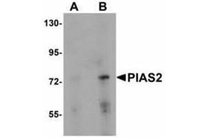 Image no. 1 for anti-Protein Inhibitor of Activated STAT, 2 (PIAS2) (N-Term) antibody (ABIN478291) (PIAS2 antibody  (N-Term))
