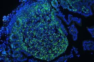 IF analysis of CD44 using anti-CD44 antibody (ABIN5692819) CD44 was detected in paraffin-embedded section of mouse lymphaden tissues.