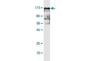 Western Blot detection against Immunogen (143 KDa) . (Vinculin antibody  (AA 1-1066))