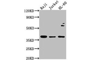 Western Blot Positive WB detected in: Raji whole cell lysate, Jurkat whole cell lysate, HL-60 whole cell lysate All lanes: RASSF2 antibody at 1:2000 Secondary Goat polyclonal to rabbit IgG at 1/50000 dilution Predicted band size: 38, 18 kDa Observed band size: 38 kDa (RASSF2 antibody  (AA 69-326))
