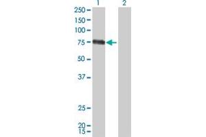Western Blot analysis of CSF1 expression in transfected 293T cell line by CSF1 monoclonal antibody (M01), clone 1A9. (M-CSF/CSF1 antibody  (AA 33-132))