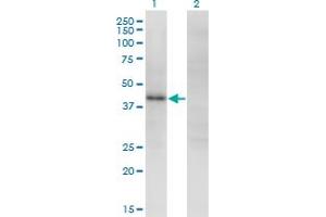 Western Blot analysis of ZSCAN16 expression in transfected 293T cell line by ZNF435 monoclonal antibody (M01), clone 4A9. (ZSCAN16 antibody  (AA 132-230))
