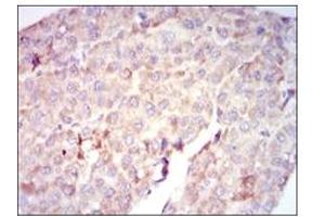 Immunohistochemistry (IHC) image for anti-V-Raf-1 Murine Leukemia Viral Oncogene Homolog 1 (RAF1) antibody (ABIN1108823)