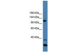 Image no. 1 for anti-Tyrosine Kinase 2 (TYK2) (AA 1021-1070) antibody (ABIN6745315) (TYK2 antibody  (AA 1021-1070))