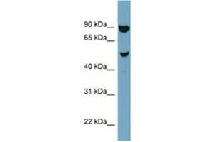 Image no. 1 for anti-Iroquois Homeobox Protein 2 (IRX2) (AA 107-156) antibody (ABIN6741969) (IRX2 antibody  (AA 107-156))